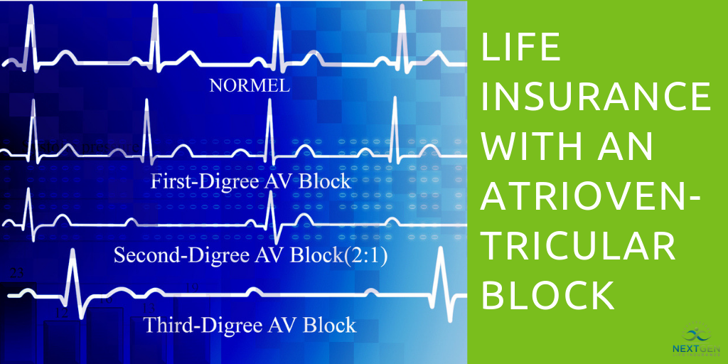 Life Insurance With An Atrioventricular Block