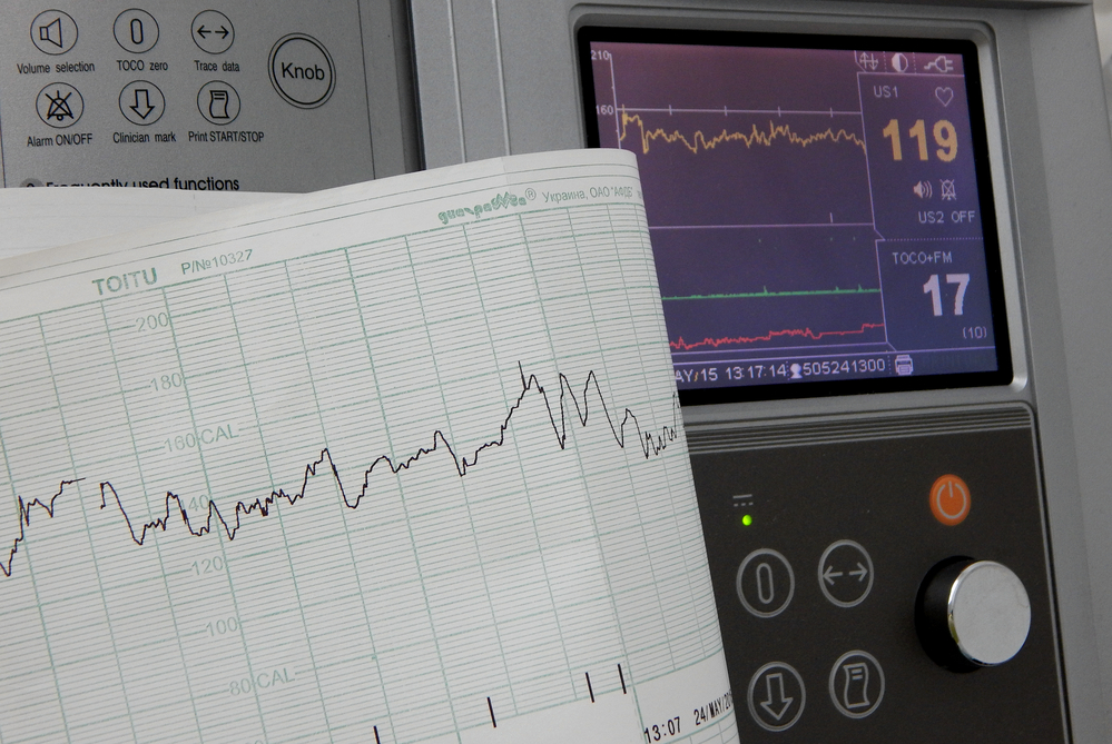 Life Insurance with Congestive Heart Failure